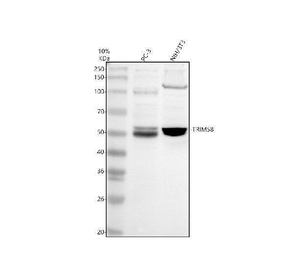 Western blot analysis of TRIM58 using anti-TRIM58 antibody (A14252-1)