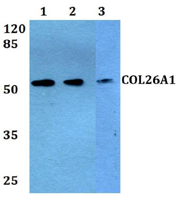 Western blot (WB) analysis of COL26A1 polyclonal antibody at 1:500 dilution
Lane1:Hela whole cell lysate
Lane2:H9C2 whole cell lysate
Lane3:PC12 whole cell lysate