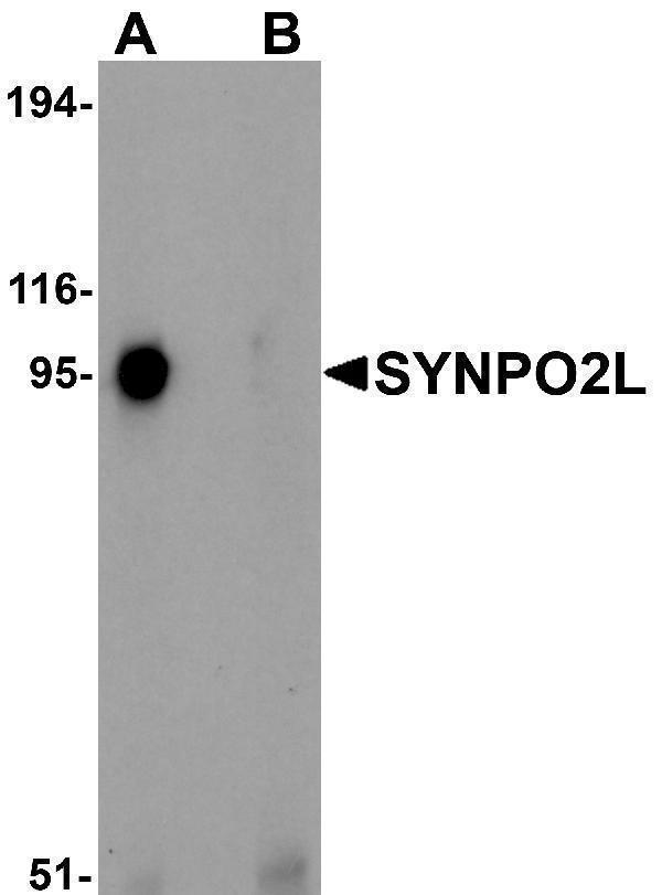 Western blot analysis of SYNPO2L in human thymus tissue lysate with SYNPO2L antibody at 1 μg/mL in (A) the absence and (B) the presence of blocking peptide
