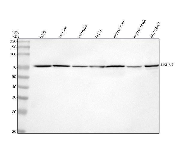  Western blot analysis of NSUN7 using anti-NSUN7 antibody (A14267)