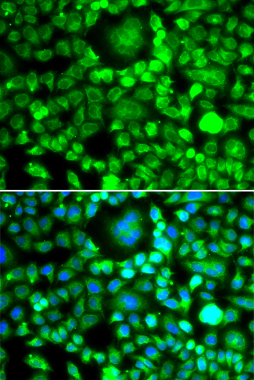 a14269 blid primary antiboties if testing 2