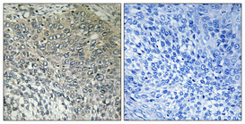 Immunohistochemistry validation of FASTKD3 using Anti-FASTKD3 Antibody (A14273-1)