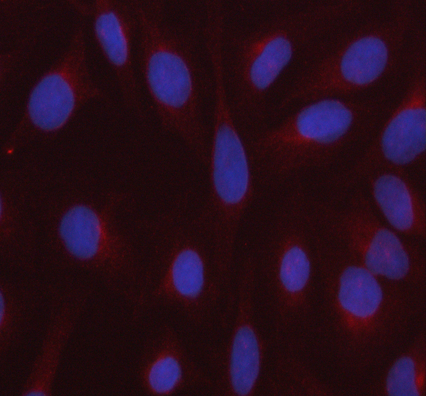 IF analysis of C20orf4/AAR2 using anti-C20orf4/AAR2 antibody (A14276-1)