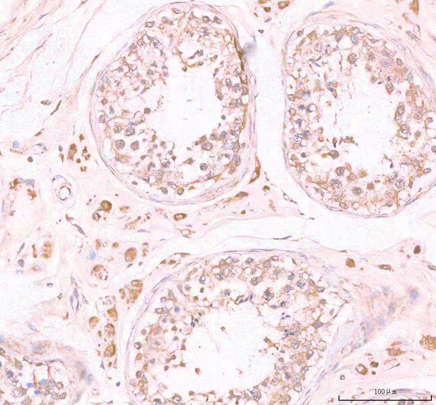 IHC analysis of C20orf4/AAR2 using anti-C20orf4/AAR2 antibody (A14276-1)