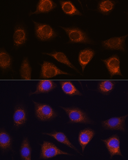 Immunofluorescence analysis of L929 cells using METTL7A Rabbit pAb  at dilution of 1:100