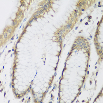 a14279 2 mettl7a primary antiboties ihc testing 3