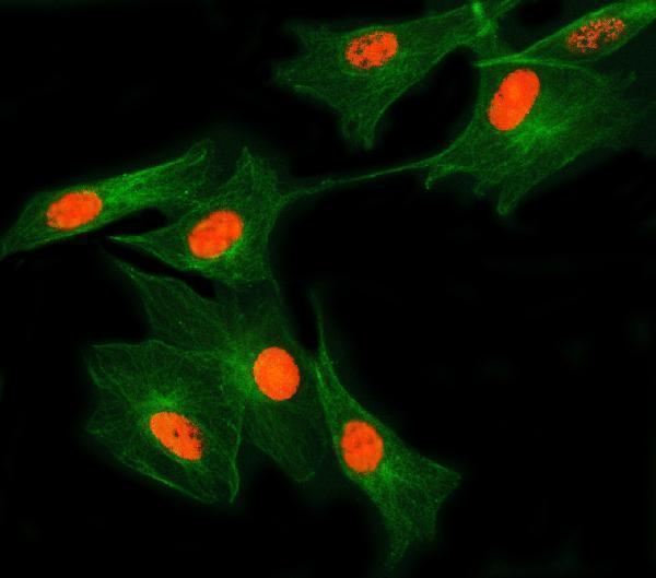 a14283 1 snrnp27 primary antibodies if testing 12