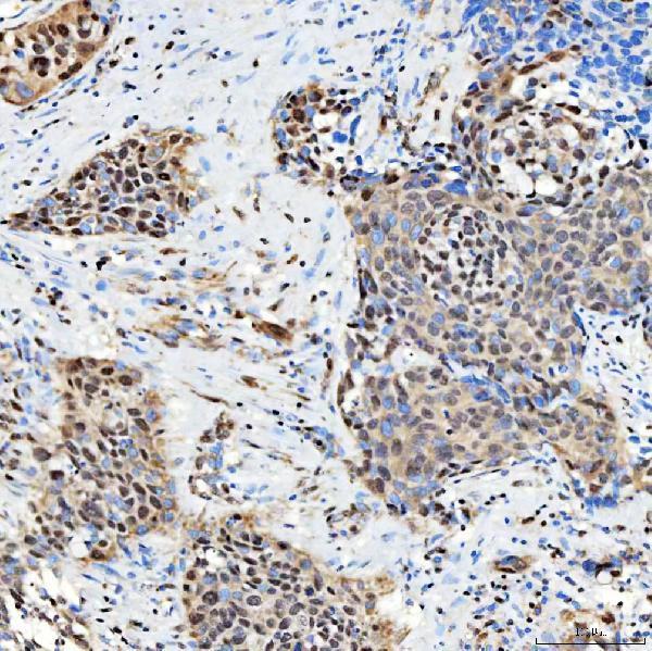 a14283 1 snrnp27 primary antibodies ihc testing 11
