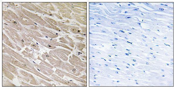 a14284 mrpl46 primary antibodies ihc testing 1