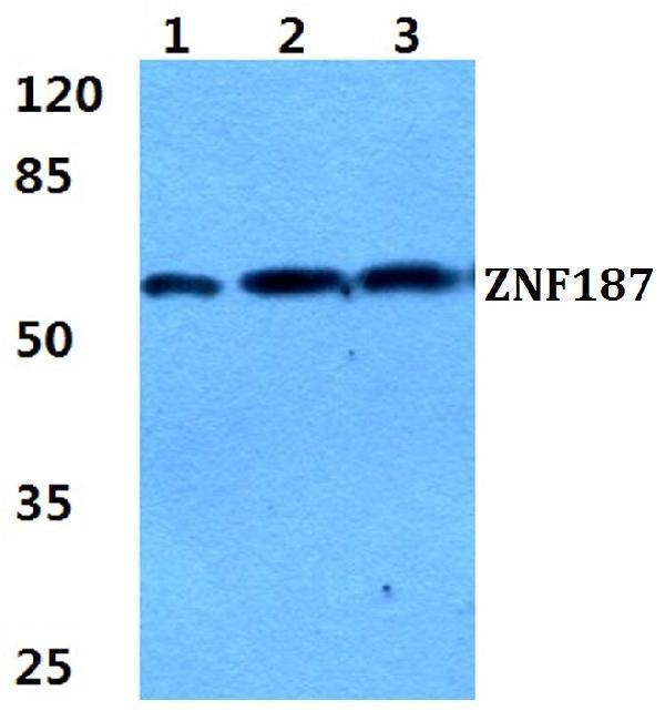 Western blot (WB) analysis of ZNF187 polyclonal antibody at 1:500 dilution
Lane1:HEK293T cell lysate
Lane2:Hela cell lysate
Lane3:sp2/0 cell lysate