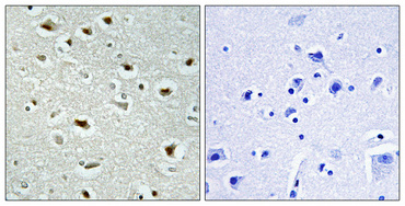 Immunohistochemical analysis of paraffin-embedded Human brain