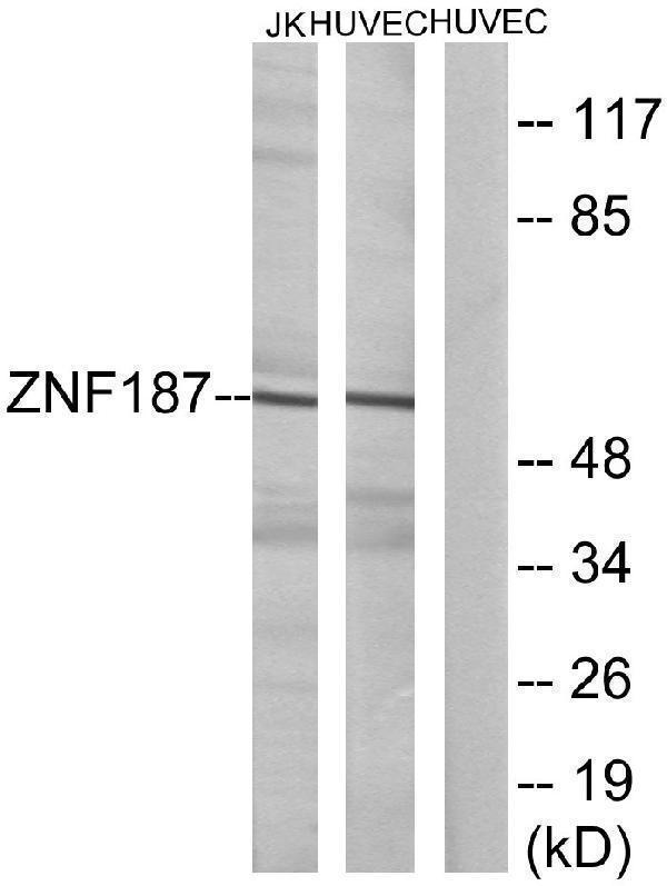 Western blot analysis of lysates from Jurkat and HUVEC cells, using ZNF187 Antibody