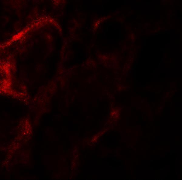 Immunofluorescence of ZF21 in human kidney tissue with ZF21 antibody at 20 μg/mL