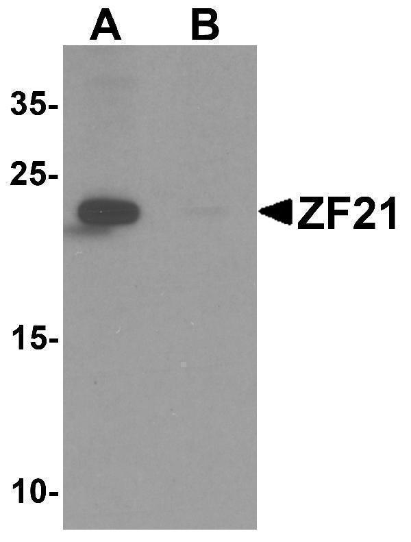 Western blot analysis of ZF21 in 3T3 cell tissue lysate with ZF21 antibody at 1 μg/ml in (A) the absence and (B) the presence of blocking peptide