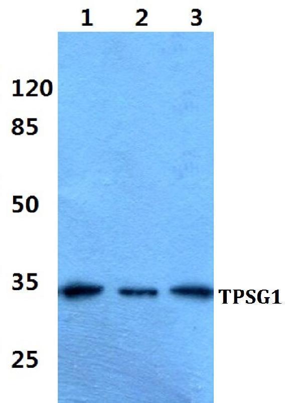 Western blot (WB) analysis of TPSG1 polyclonal antibody at 1:500 dilution
Lane1:A549 cell lysate
Lane2:sp2/0 cell lysate
Lane3:H9C2 cell lysate