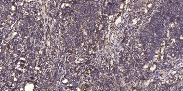 a14322 sptbn4 primary antibodies ihc testing 1