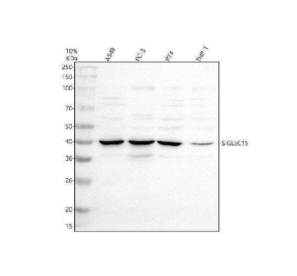 Western blot analysis of SIGLEC15 using anti-SIGLEC15 antibody (A14323-1)
