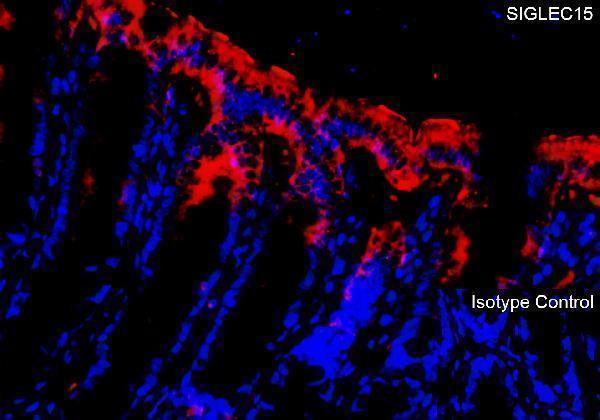 a14323 siglec15 primary antibodies if testing 3