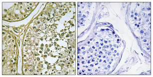 a14331 1 csnk1a1l primary antibodyes ihc testing 1