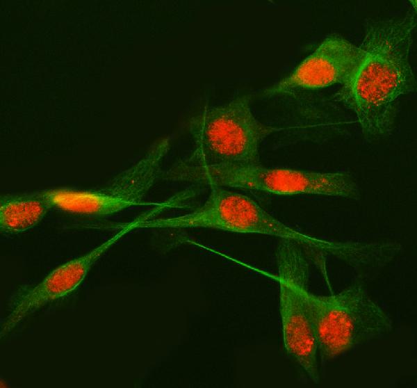 Figure 2. IF analysis of METTL17 using anti-METTL17 antibody (A14339-1) and anti-Beta Tubulin antibody (M01857-3). METTL17 was detected in immunocytochemical section of HELA cell. Enzyme antigen retrieval was performed using IHC enzyme antigen retrieval reagent (AR0022) for 15 mins. The cells were blocked with 10% goat serum. And then incubated with 5 microg/mL rabbit anti-METTL17 Antibody (A14339-1) and mouse anti-Beta Tubulin antibody (M01857-3) overnight at 4°C. Cy3 Conjugated Goat Anti-Rabbit IgG (BA1032) and DyLight®488 Conjugated Goat Anti-Mouse IgG (BA1126) were used as secondary antibody at 1:500 dilution and incubated for 30 minutes at 37°C. Visualize using a fluorescence microscope and filter sets appropriate for the label used. Figure 2. IF analysis of METTL17 using anti-METTL17 antibody (A14339-1) and anti-Beta Tubulin antibody (M01857-3). METTL17 was detected in immunocytochemical section of HELA cell. Enzyme antigen retrieval was performed using IHC enzyme antigen retrieval reagent (AR0022) for 15 mins. The cells were blocked with 10% goat serum. And then incubated with 5 microg/mL rabbit anti-METTL17 Antibody (A14339-1) and mouse anti-Beta Tubulin antibody (M01857-3) overnight at 4°C. Cy3 Conjugated Goat Anti-Rabbit IgG (BA1032) and DyLight®488 Conjugated Goat Anti-Mouse IgG (BA1126) were used as secondary antibody at 1:500 dilution and incubated for 30 minutes at 37°C. Visualize using a fluorescence microscope and filter sets appropriate for the label used.