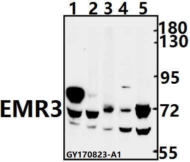 Western blot (WB) analysis of EMR3 (Y652) pAb at 1:500 dilution
Lane1:H9C2 whole cell lysate(40ug)
Lane2:CT26 whole cell lysate(40ug)
Lane3:HepG2 whole cell lysate(40ug)
Lane4:MCF-7 whole cell lysate(40ug)
Lane5:K562 whole cell lysate(40ug)