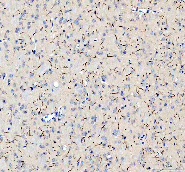 a14356 2 trim46 primary antibodies ihc testing 1