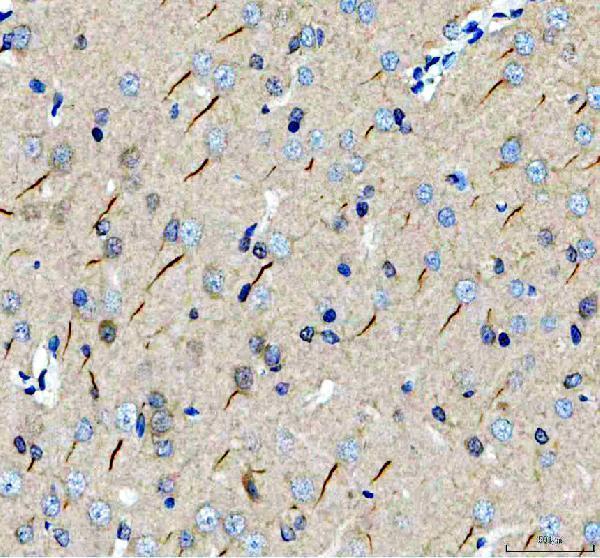 a14356 2 trim46 primary antibodies ihc testing 2