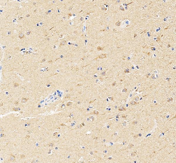 a14356 2 trim46 primary antibodies ihc testing 3
