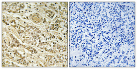a14358 2 nol10 primary antibodies ihc testing 1
