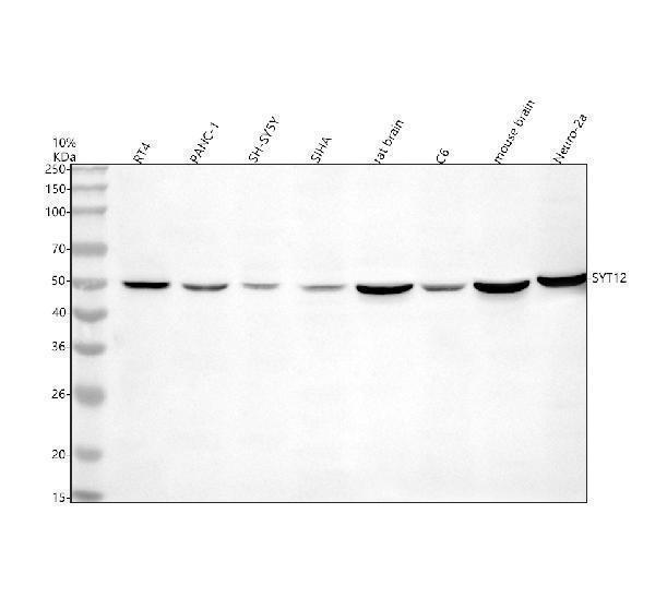  Western blot analysis of Synaptotagmin-12/SYT12 using anti-Synaptotagmin-12/SYT12 antibody (A14373-1)