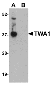 a14387 gid8 primary antibodies wb testing 1
