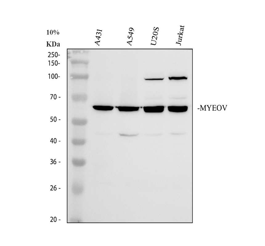 Western blot analysis of MYEOV using anti-MYEOV antibody (A14391-1)