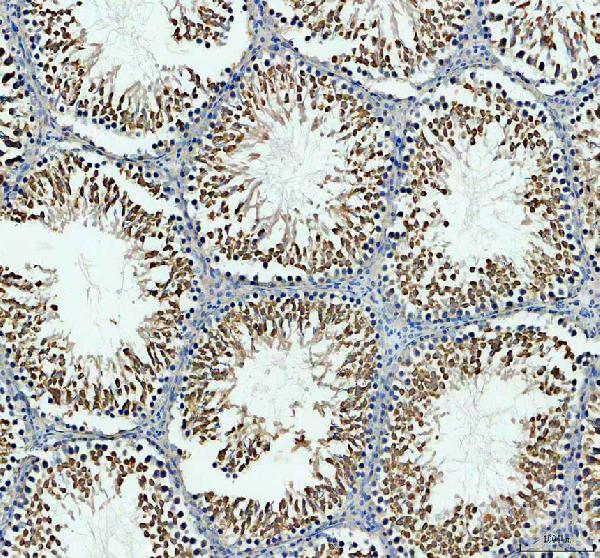 IHC analysis of GKAP1 using anti-GKAP1 antibody (A14397-1)