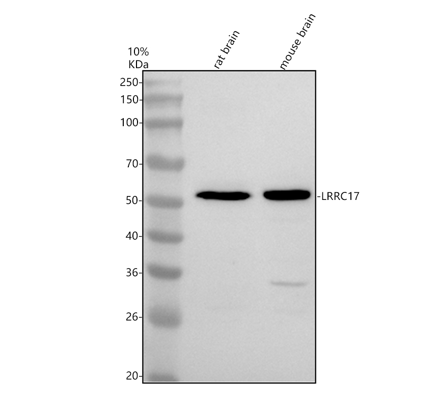 Western blot analysis of LRRC17 using anti-LRRC17 antibody (A14400-1)