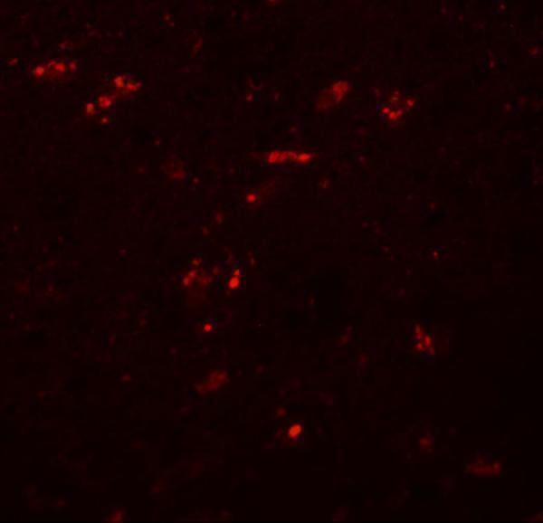 Immunofluorescence of ZNF536 in human brain tissue with ZNF536 antibody at 20 μg/mL