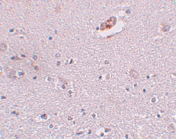 Immunohistochemistry of ZNF536 in human brain tissue with ZNF536 antibody at 5 μg/mL