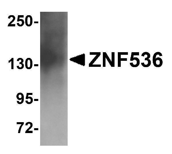 Western blot analysis of ZNF536 in human brain tissue lysate with ZNF536 antibody at 1 μg/mL