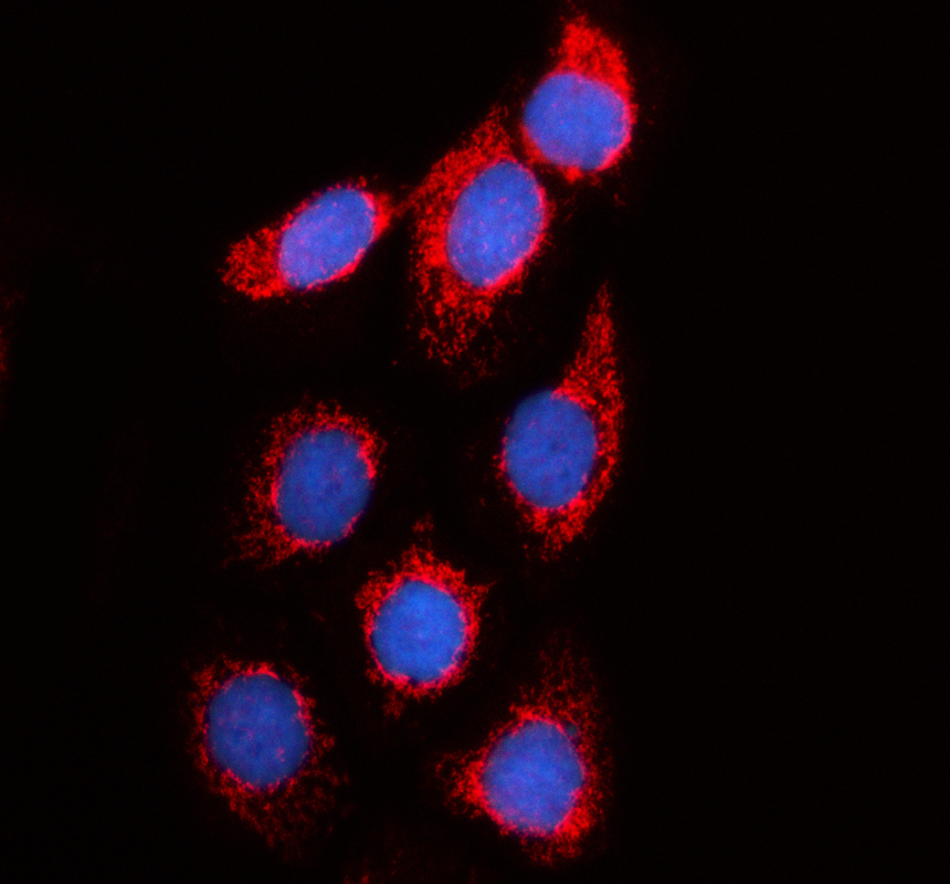 a14408 1 mrps17 primary antibodies if testing 1