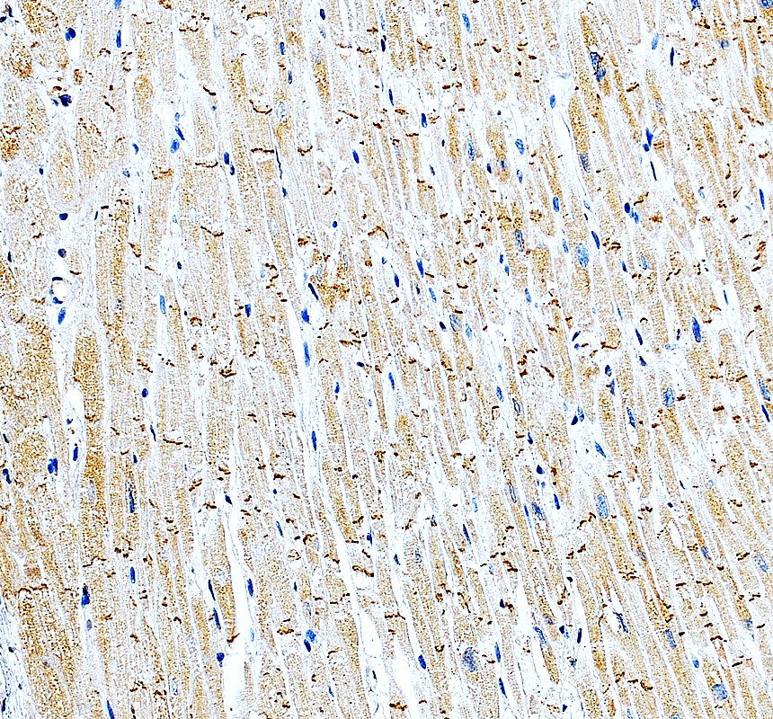 IHC analysis of MRPS17 using anti-MRPS17 antibody (A14408-1)