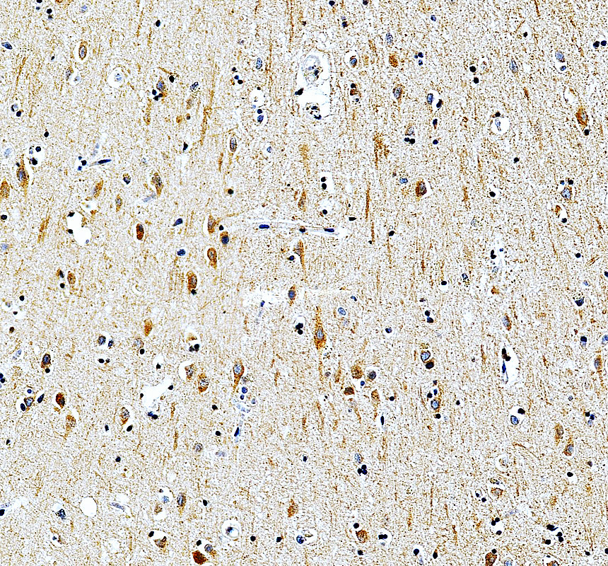 IHC analysis of MRPS17 using anti-MRPS17 antibody (A14408-1)