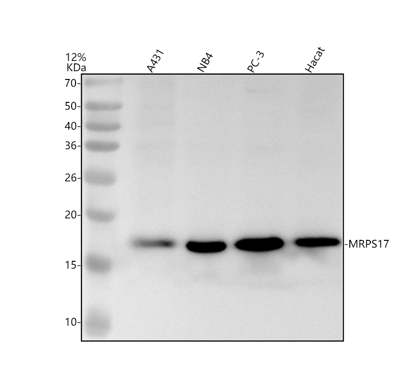 Western blot analysis of MRPS17 using anti-MRPS17 antibody (A14408-1)