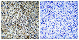 a14430 1 mrpl4 primary antibodies ihc testing 1