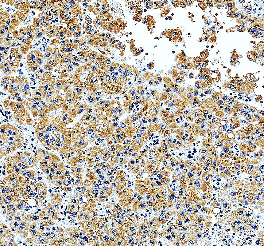 a14430 2 mrpl4 primary antibodies ihc testing 1