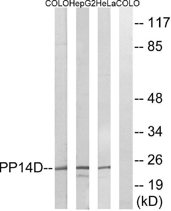 Western blot analysis of lysates from HeLa, HepG2, and COLO cells, using PPP1R14D Antibody