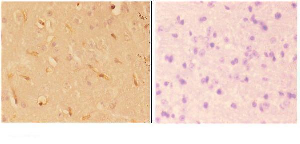 a14435 abhd4 primary antiboties ihc testing 2