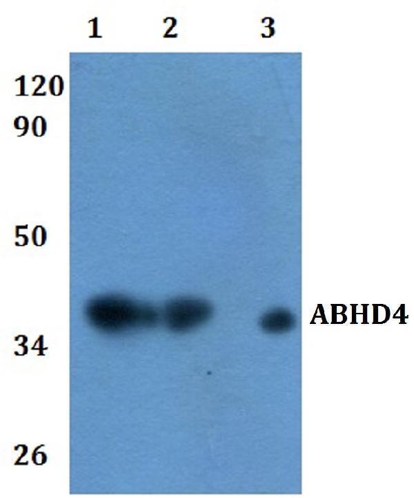 a14435 abhd4 primary antiboties wb testing 1