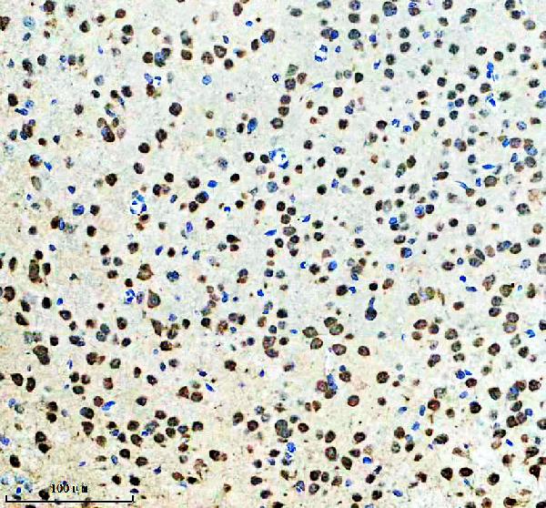 IHC analysis of YTHDF3 using anti-YTHDF3 antibody (A14443-1)