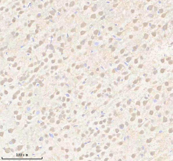 IHC analysis of YTHDF3 using anti-YTHDF3 antibody (A14443-1)