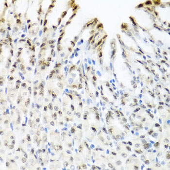a14443 ythdf3 primary antiboties ihc testing 3