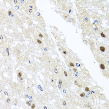 a14443 ythdf3 primary antiboties wb testing 2